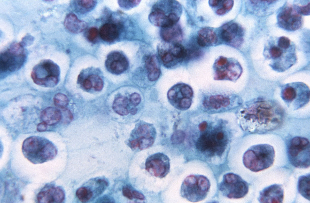 CDC Microscopic image