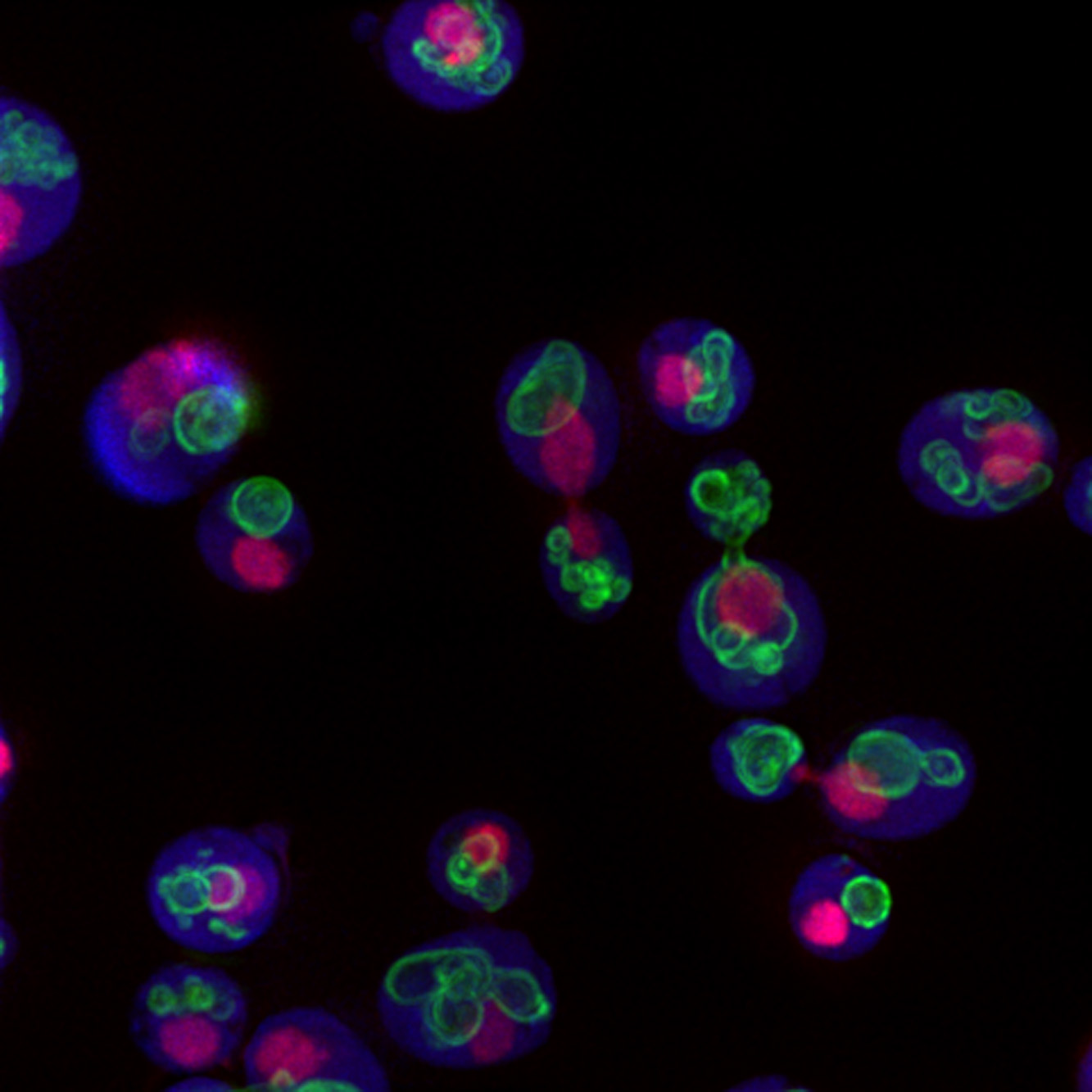 Yeast cells (purple) with DNA-containing nuclei (pink) and a protein (green) that resides in the cell’s waste compartment or vacuole.
