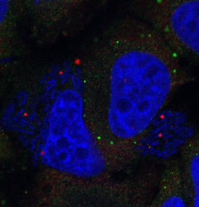 Infection with Shigella bacteria for 4 hours causes human cells to move their splicing machinery “scissors” (stained in red) into storage sites known as U bodies. The nuclei of the cells and the Shigella (small rod-like structures) are stained blue.