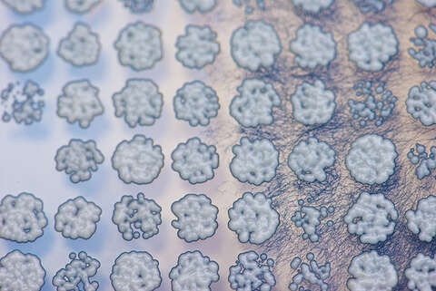 COLONIES OF BAKER'S YEAST CELLS GROWING IN A PETRI DISH